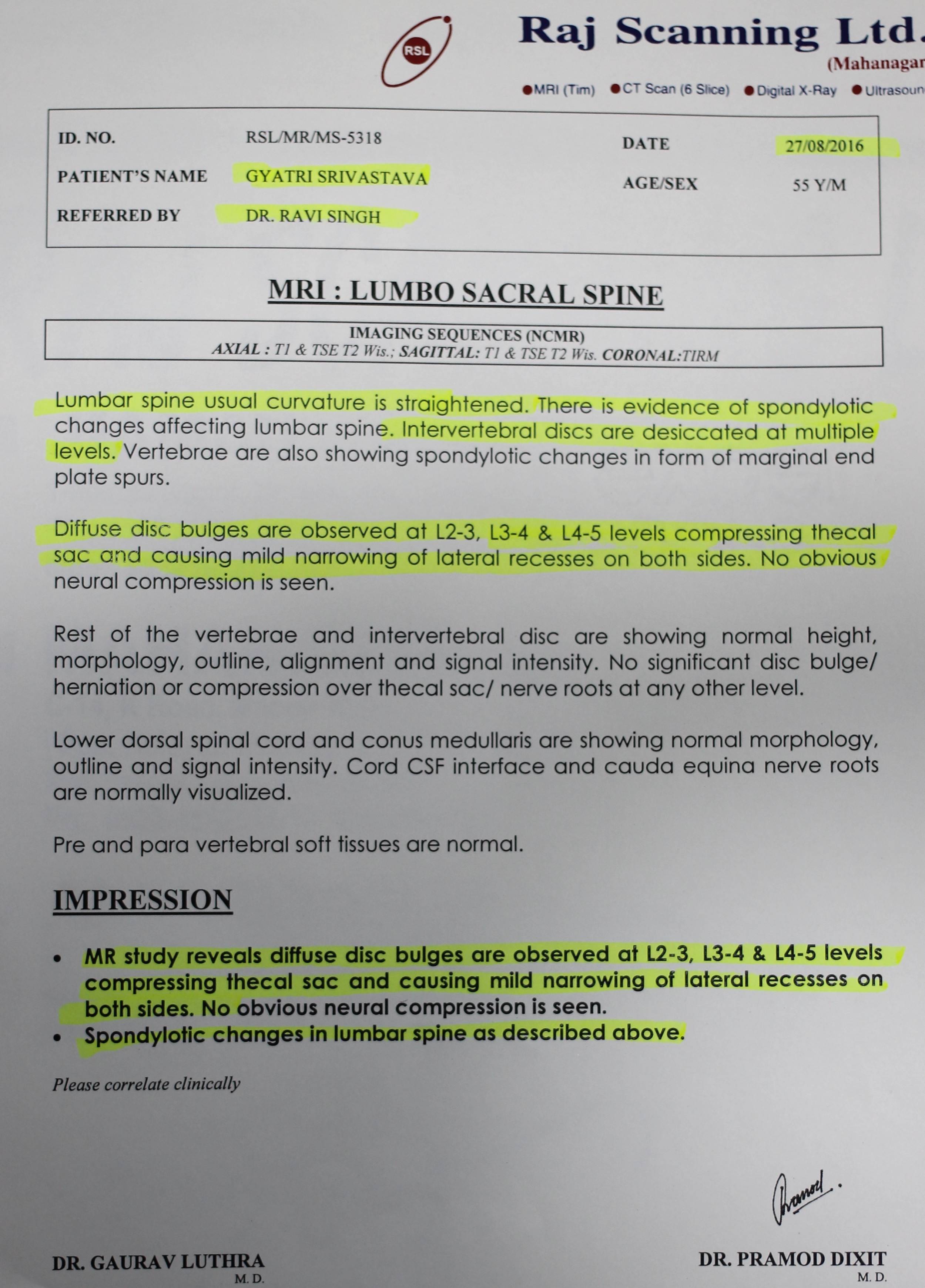 Successful Treatment Of Brain Tumor With Homeopathy Case Study